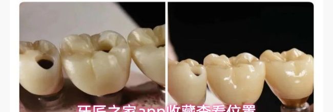 牙匠之家app收藏查看位置