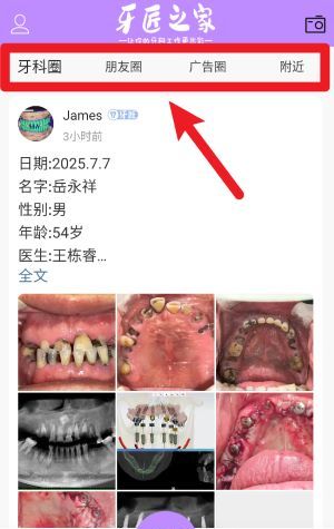 牙匠之家app使用说明